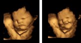 یک کشف علمی شگفت انگیز: جنین در رحم مادر به مزه واکنش نشان می‌دهد