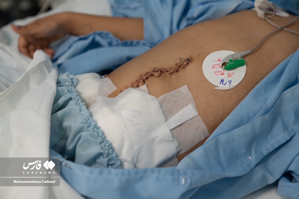 تصاویر: آخرین وضعیت مجروحین حمله به حرم شاهچراغ