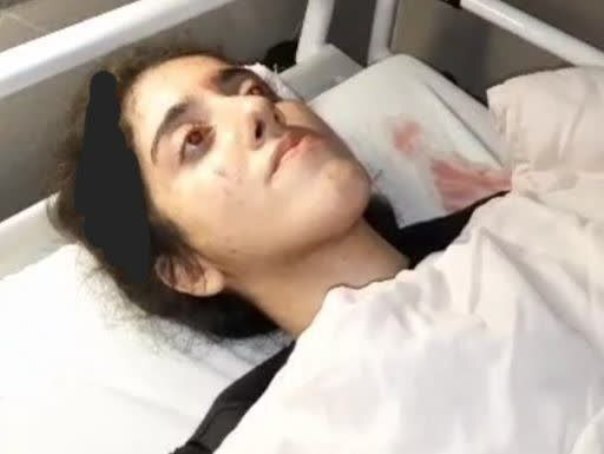 پلیس با تکذیب کشته شدن دختر ۲۰ ساله در پیاده راه فرهنگی رشت: او از ناحیه سر دچار آسیب شده / پس از معاینات پزشکی و تهیه عکس رادیولوژی مشخص شد موضوع صدمه وارده به او چندان جدی نبوده