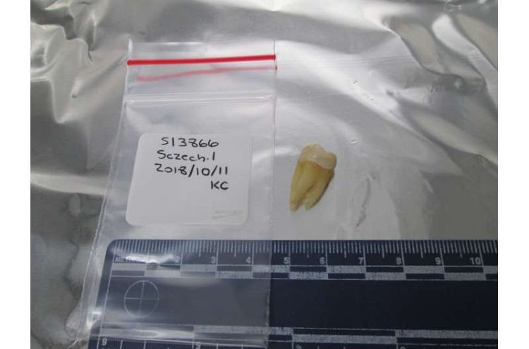 سرنخ‌هایی جدید از منشا یهودیان اشکنازی؛ مطالعه بر روی دندان‌های کشف شده از قرون وسطی در آلمان