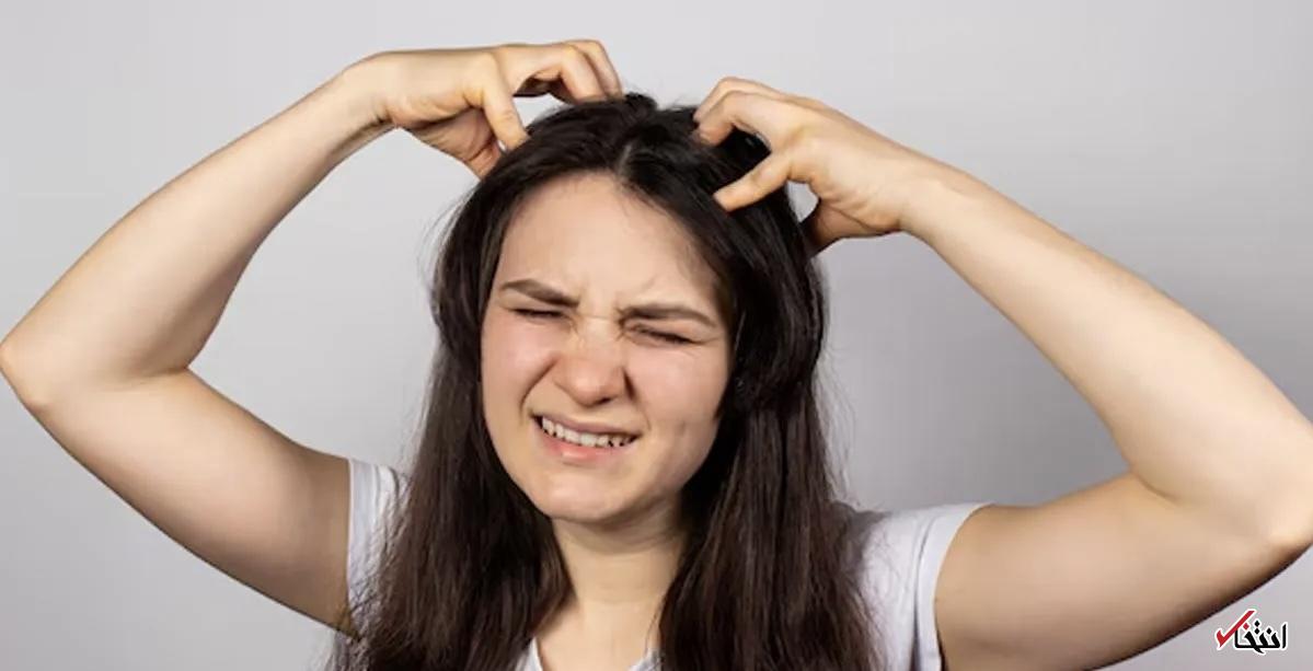 خارش پوست سر بدون شوره؛ ۶ دلیل پنهان که باید بدانید