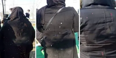 عامل اسیدپاشی در یکی از پارک های شهرستان شهریار دستگیر شد