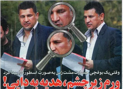 عکس: صورت مشت خورده ی علی دایی پس از درگیری با بوقچی!