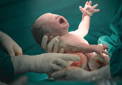 علوم پزشکی البرز: آمار منتشرشده درباره زایمان مادران افغانستانی در کرج نادرست بود؛ این آمار در سه سال اخیر کمتر از ۲۱ درصد است