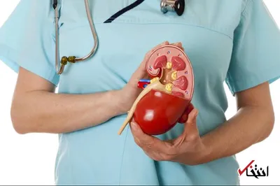 چگونه از سنگ کلیه پیشگیری کنیم؟