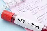 ترکیب دارویی جدید می‌تواند ویروس HIV را در بیمارانی که به درمان مقاوم شده‌اند، کنترل کند