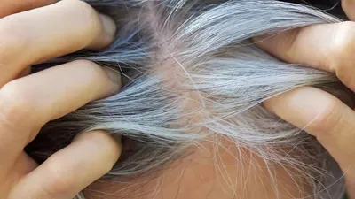 مطالعه جدید ارتباط پنهان میان سفیدی مو و سرطان را نشان می‌دهد