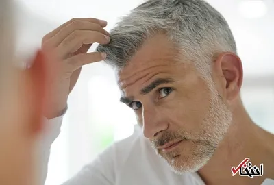 روش‌های جلوگیری از سفیدی مو