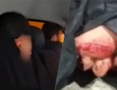 افشای اقدام عجیب متحصنین مقابل مجلس: این زن، صورت خود را دیشب پاره کرد تا بگوید فراجا با او برخورد فیزیکی کرده است