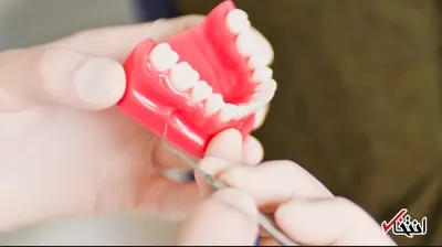 چگونه خونریزی لثه را متوقف کنیم؟