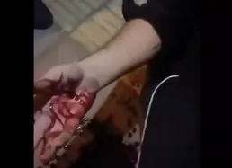 ببینید/ لحظه دستگیری عامل کتک زدن دختران جوان با دست زخمی