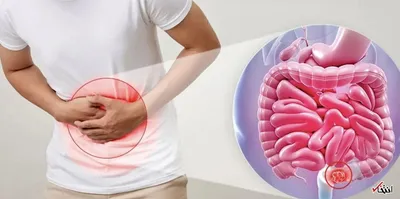 هفت عادت مخرب برای سلامت روده