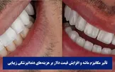 تأثیر مکانیزم ماشه و نرخ ارز بر هزینه‌های دندانپزشکی زیبایی در سال 1404