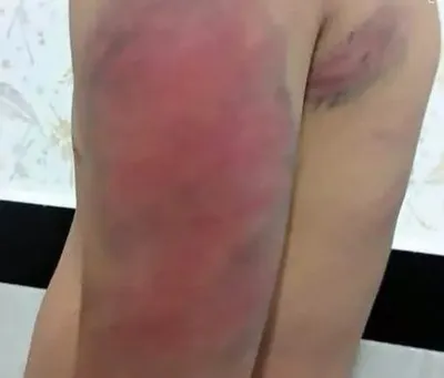 واکنش نماینده مجلس به خشونت علیه دانش‌آموزان: آموزش و پرورش از به‌کارگیری افراد عقده‌ای و کینه‌توز اجتناب کند