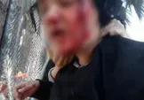 ضرب و شتم پناهجویان افغانستانی توسط پلیس ترکیه / یکی پناهجویان: پلیس ترکیه تنها در برابر دوربین خبرنگاران به ما نان و آب می‌دهند