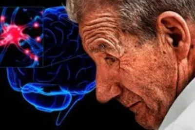 ماده شیمیایی چربی زدا با احتمال بیشتر پارکینسون مرتبط است