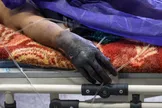 اورژانس کشور: ۳۳۱ نفر در حوادث مرتبط با چهارشنبه سوری مصدوم شدند/ ۱۲ نفر قطع عضو و ۷۹ نفر آسیب چشمی