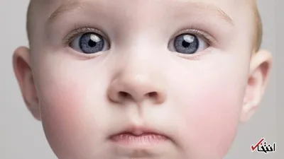 ریشه‌های زوال عقل تا دوران کودکی امتداد دارند